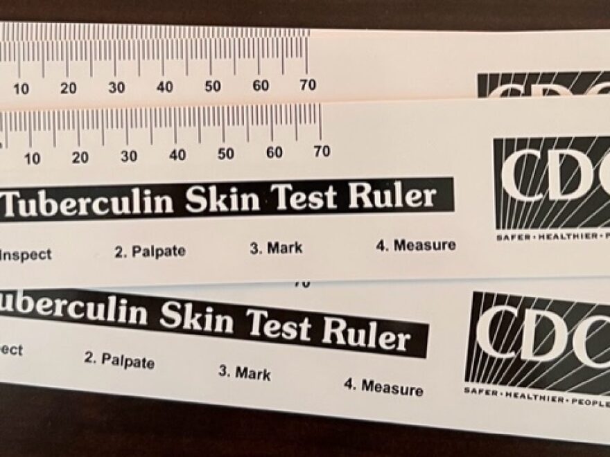 FREE Skin Test Rulers Up To 200 Freebie Depot