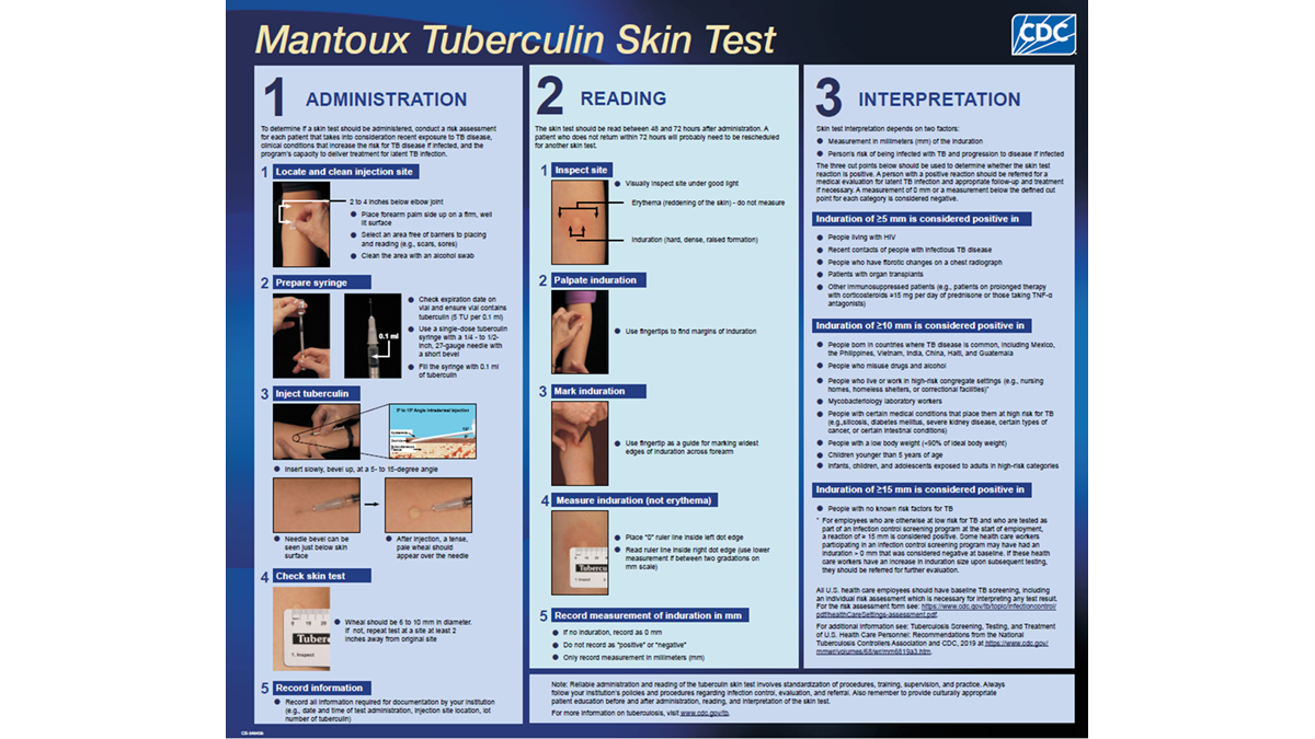 Mantoux Tuberculin Skin Testing Wall Chart Tuberculosis TB CDC